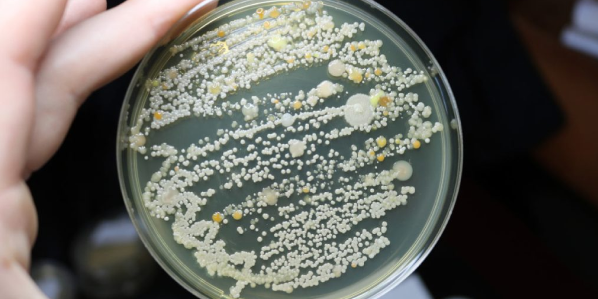 Use a Mold Test Kit Use a Mold Test Kit